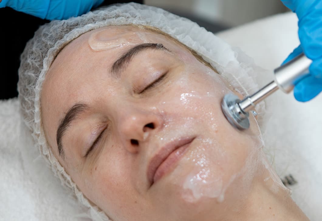 radiofrecuencia facial